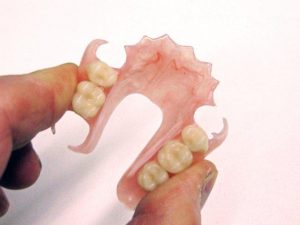 Flexite Denture Dr Muzzafar Zaman